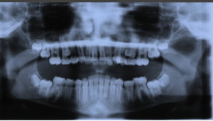 Denti