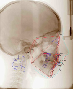 Radiografia
